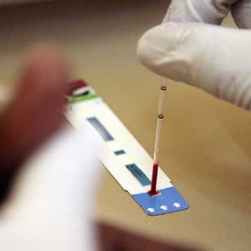 The role of syphilis dipstick testing