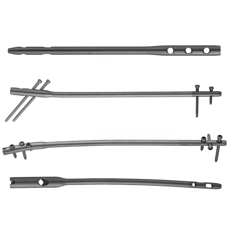 Tibial Interlocking Nail